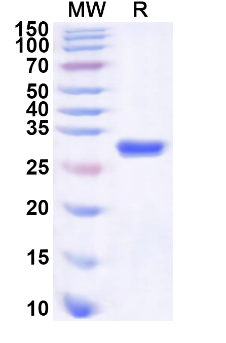 SDS-PAGE for Recombinant Human TAP2 Protein, N-His