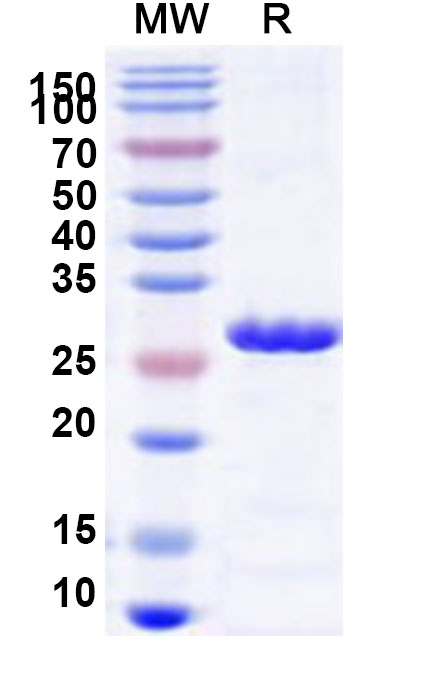 SDS-PAGE for Recombinant Human TBC1D4 Protein, N-His