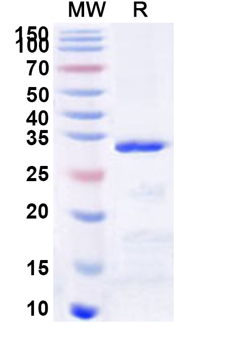 SDS-PAGE for Recombinant Human TBKBP1 Protein, N-GST & C-His