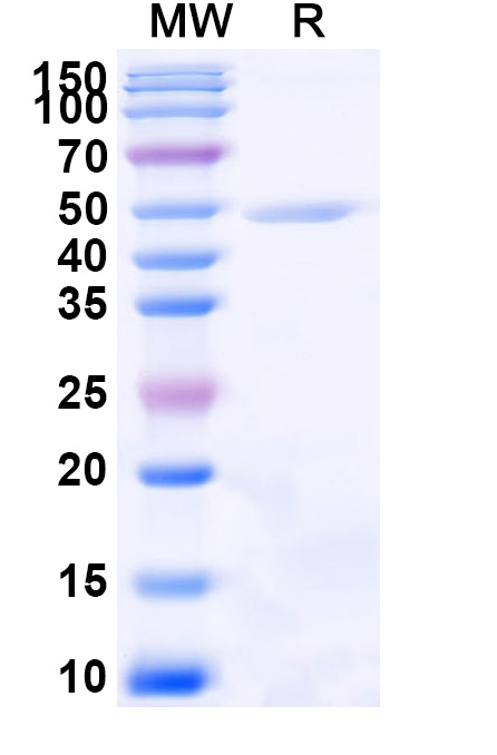 SDS-PAGE for Recombinant Human TCN1 Protein, N-His