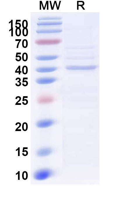 SDS-PAGE for Recombinant Human TDO2 Protein, N-His