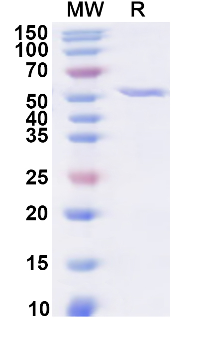 SDS-PAGE for Recombinant Human TEC Protein, N-His