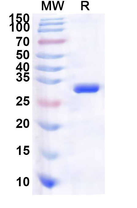 SDS-PAGE for Recombinant Human TESK1 Protein, N-His
