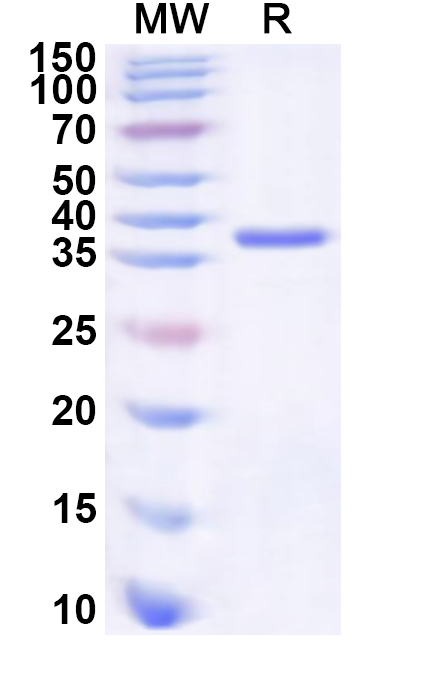SDS-PAGE for Recombinant Human TGFBR3 Protein, N-His