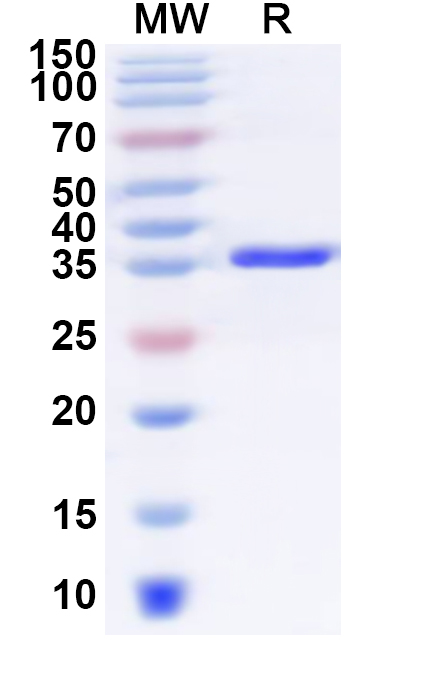 SDS-PAGE for Recombinant Human TIMM17B Protein, N-GST & C-His