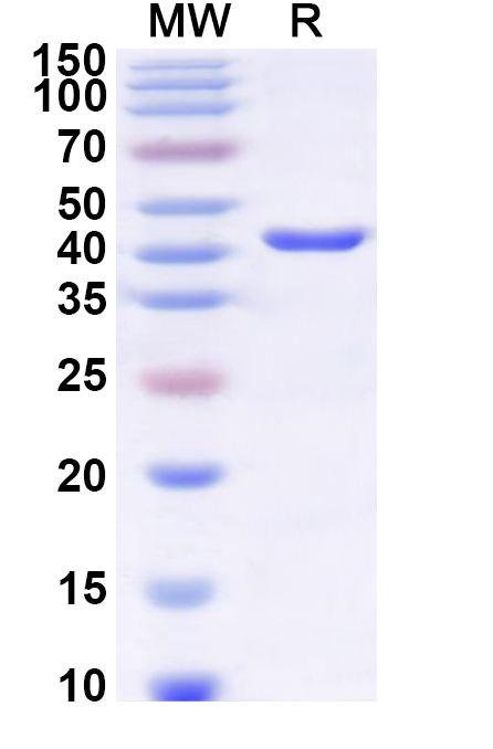 SDS-PAGE for Recombinant Human TIMM22 Protein, N-GST & C-His