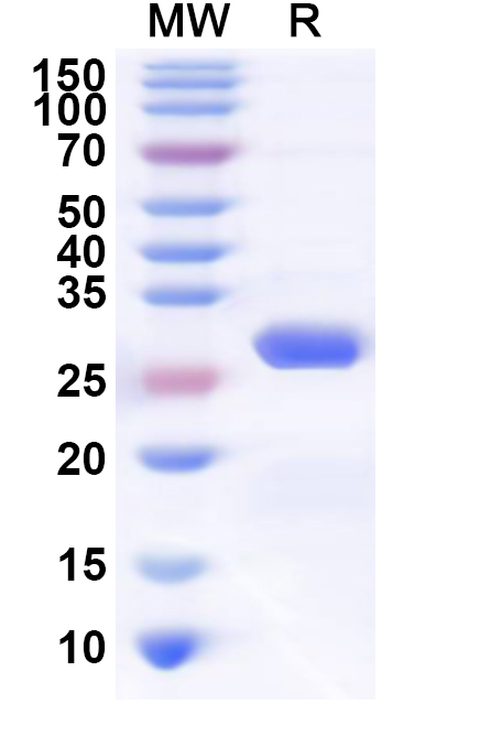 SDS-PAGE for Recombinant Human TJAP1 Protein, N-His
