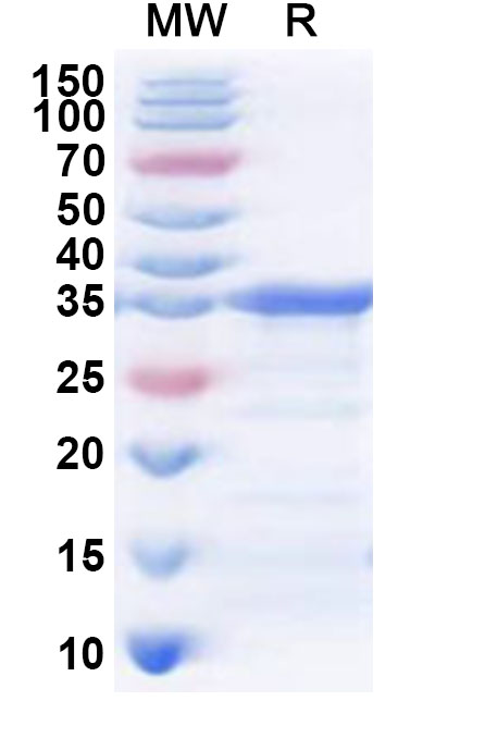 SDS-PAGE for Recombinant Human TKFC Protein, N-His