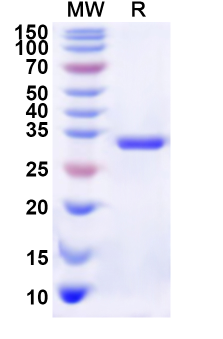 SDS-PAGE for Recombinant Human TKTL1 Protein, N-His