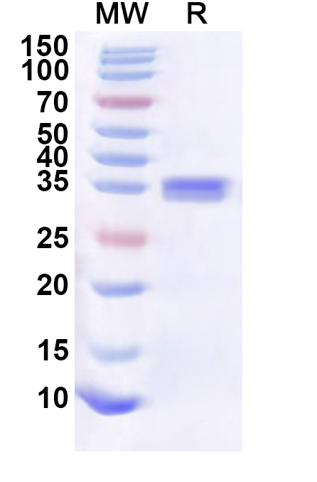 SDS-PAGE for Recombinant Human TLE5 Protein, N-His-KSI