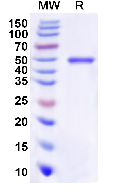 SDS-PAGE for Recombinant Human TLX1 Protein, N-His-KSI