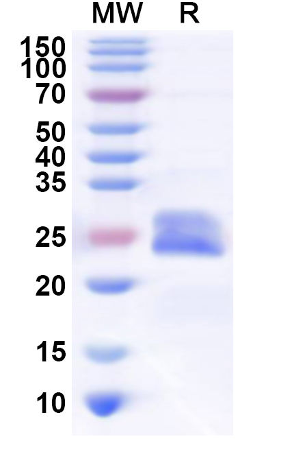 SDS-PAGE for Recombinant Human TMEM201 Protein, N-His