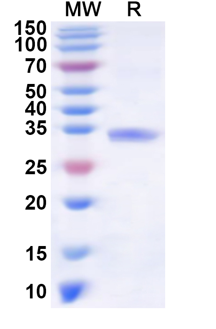 SDS-PAGE for Recombinant Human TNFAIP1 Protein, N-His