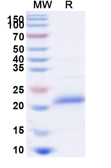 SDS-PAGE for Recombinant Human TNFRSF10C Protein, N-His