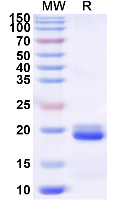 SDS-PAGE for Recombinant Human TOM1L2 Protein, N-His