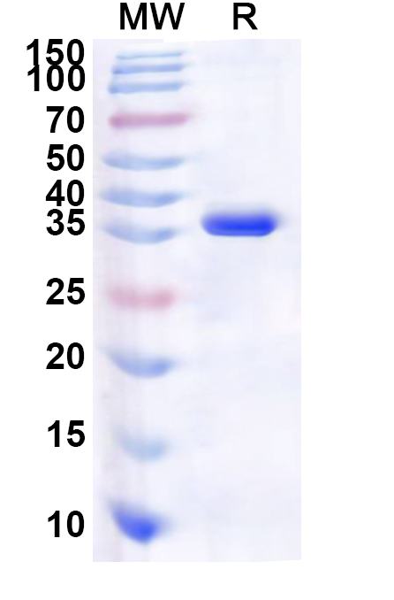 SDS-PAGE for Recombinant Human TOMM34 Protein, N-His