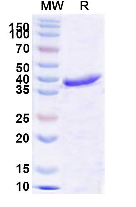 SDS-PAGE for Recombinant Human TOP1 Protein, N-His