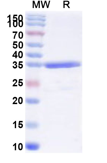 SDS-PAGE for Recombinant Human TOX3 Protein, N-GST & C-His