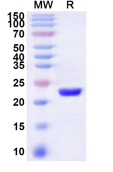 SDS-PAGE for Recombinant Human TRAM1 Protein, N-His-KSI