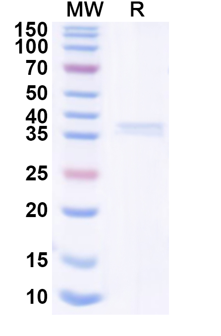 SDS-PAGE for Recombinant Human TRAPPC10 Protein, N-His