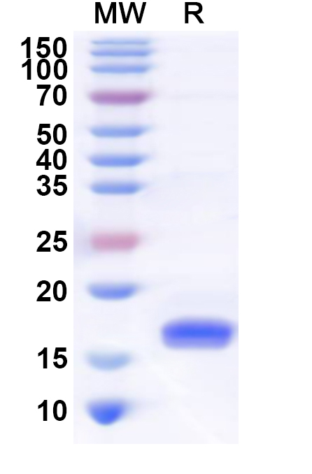 SDS-PAGE for Recombinant Human TREML2 Protein, N-His
