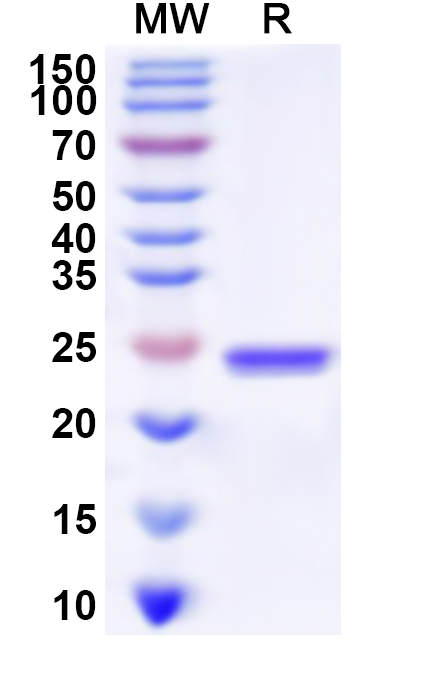 SDS-PAGE for Recombinant Human TRIM23 Protein, N-His