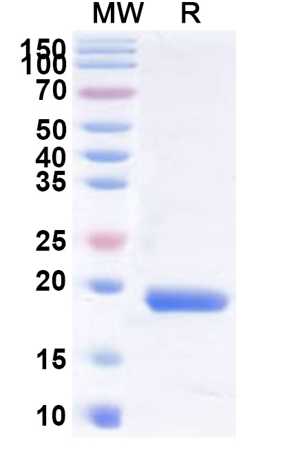 SDS-PAGE for Recombinant Human TRIP4 Protein, N-His