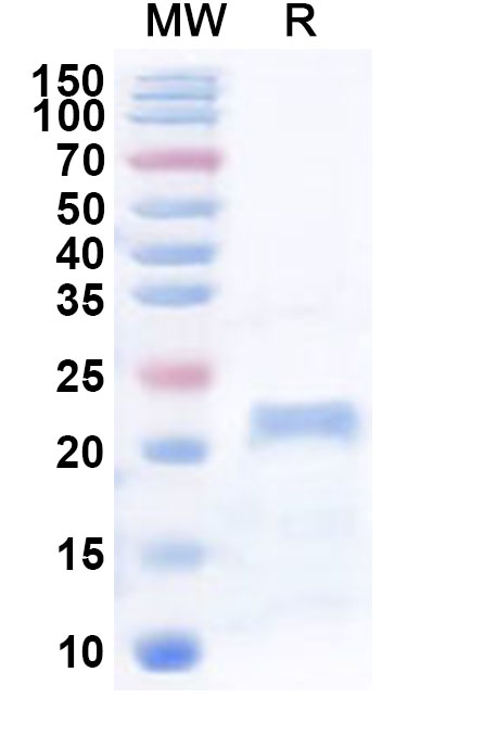 SDS-PAGE for Recombinant Human TRIP6 Protein, N-His