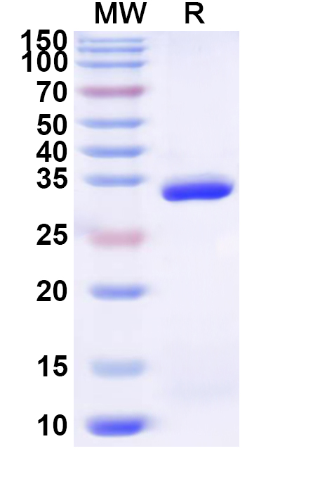 SDS-PAGE for Recombinant Human TRMT10B Protein, N-His