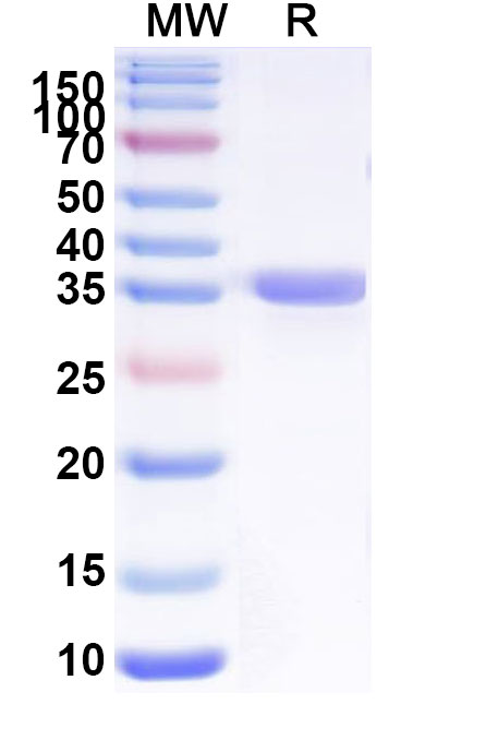 SDS-PAGE for Recombinant Human TRPA1, N-His