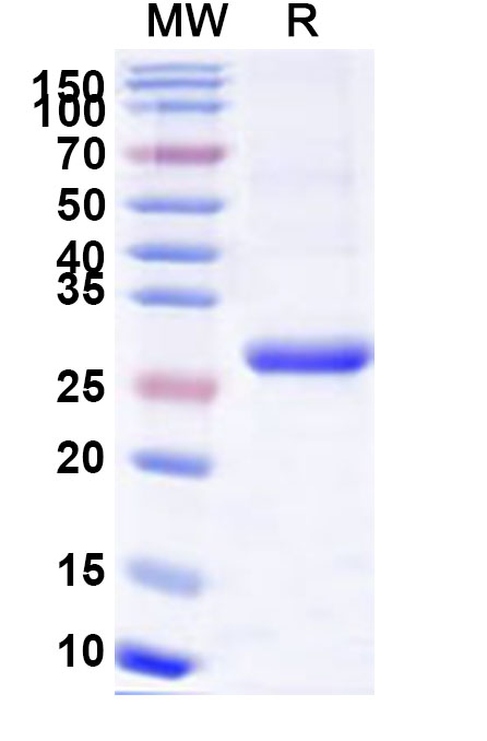 SDS-PAGE for Recombinant Human TSHR, N-His