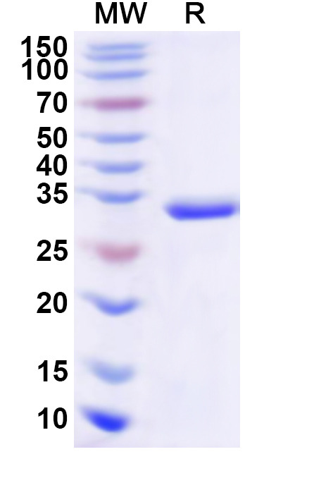 SDS-PAGE for Recombinant Human TTPA Protein, N-His