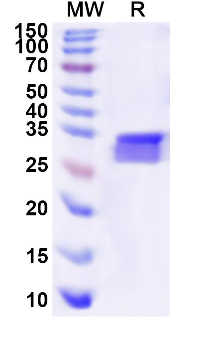 SDS-PAGE for Recombinant Human TUB Protein, N-His