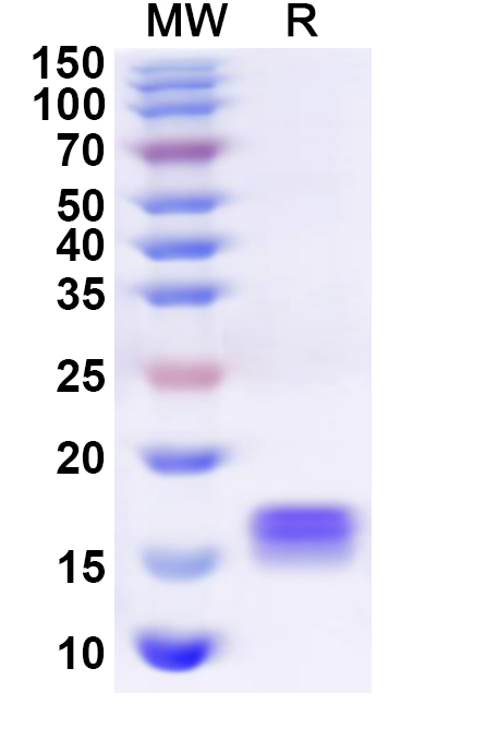 SDS-PAGE for Recombinant Human TXNL4A Protein, N-His