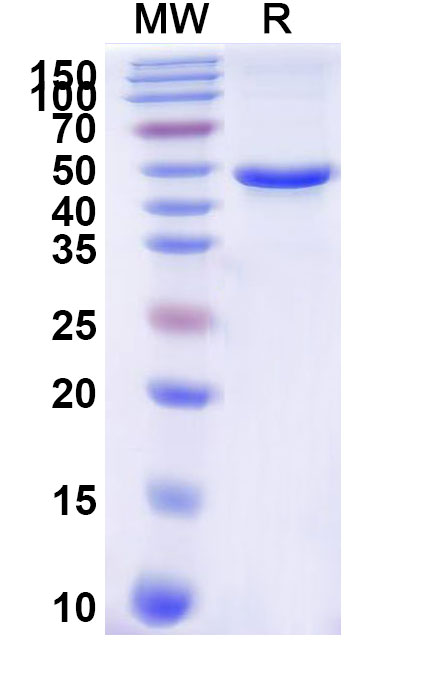 SDS-PAGE for Recombinant Human TYR/Tyrosinase Protein, N-His