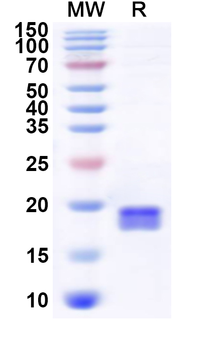 SDS-PAGE for Recombinant Human UBE2A Protein, N-His