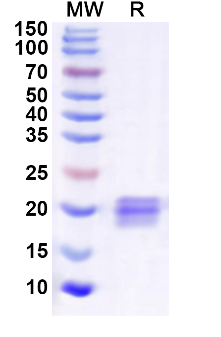 SDS-PAGE for Recombinant Human UBE2H Protein, N-His