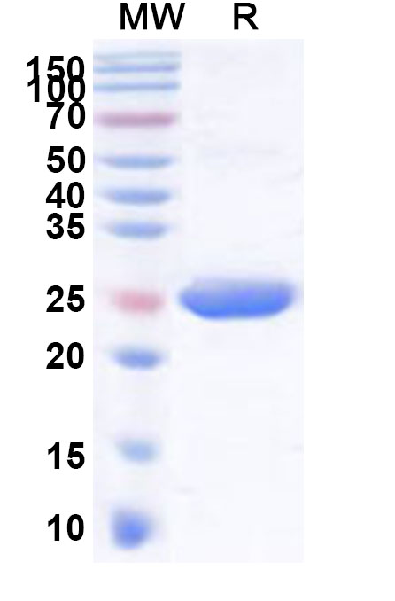 SDS-PAGE for Recombinant Human UBE2R2 Protein, N-His