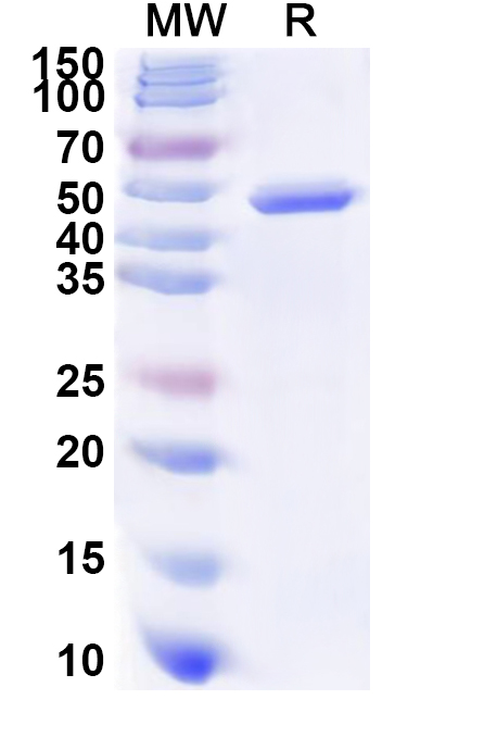 SDS-PAGE for Recombinant Human UGT1A1 Protein, N-His