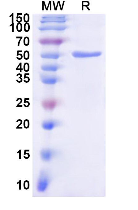 SDS-PAGE for Recombinant Human UGT1A6 Protein, N-His