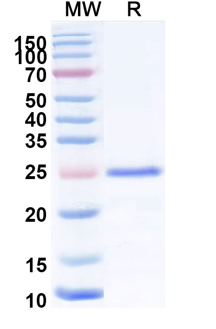 SDS-PAGE for Recombinant Human UHRF1 Protein, N-His