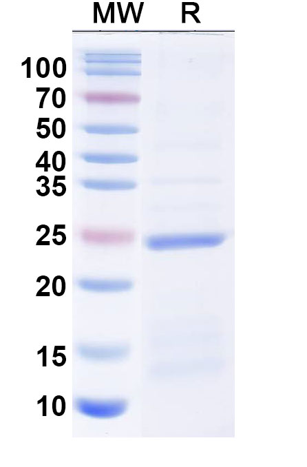 SDS-PAGE for Recombinant Human UPK3A, N-His