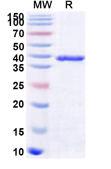 SDS-PAGE for Recombinant Human USP12 Protein, N-His