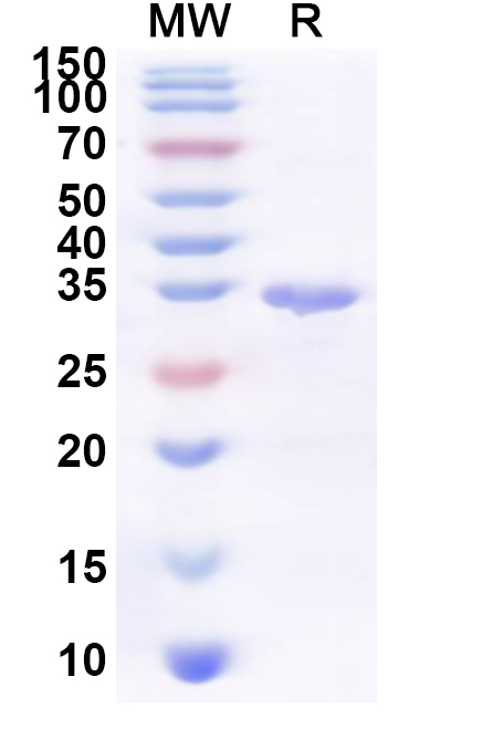SDS-PAGE for Recombinant Human USP43 Protein, N-His