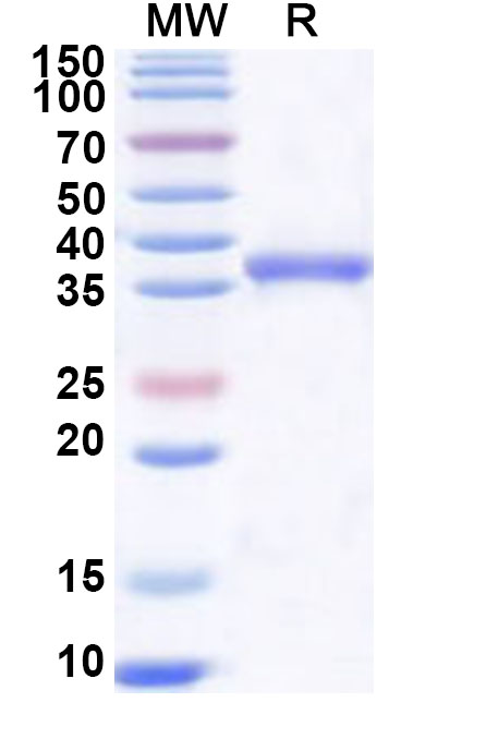 SDS-PAGE for Recombinant Human USP48 Protein, N-His