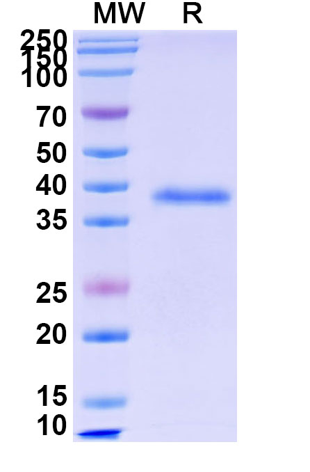 SDS-PAGE for Recombinant Human VCAN, N-His