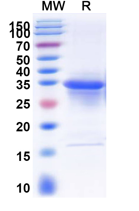 SDS-PAGE for Recombinant Human VDAC1, N-His