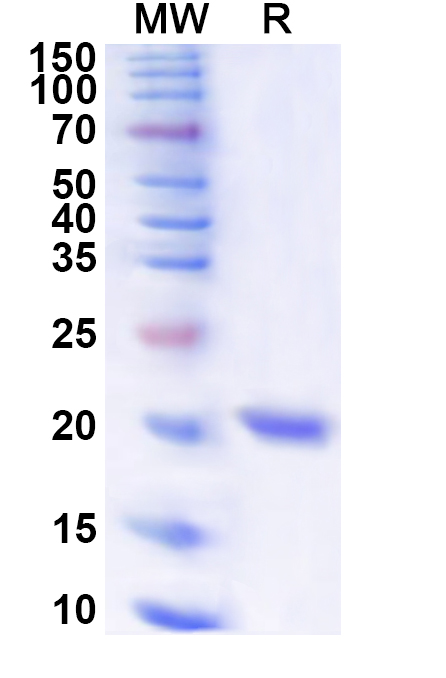 SDS-PAGE for Recombinant Human VEZF1 Protein, N-His
