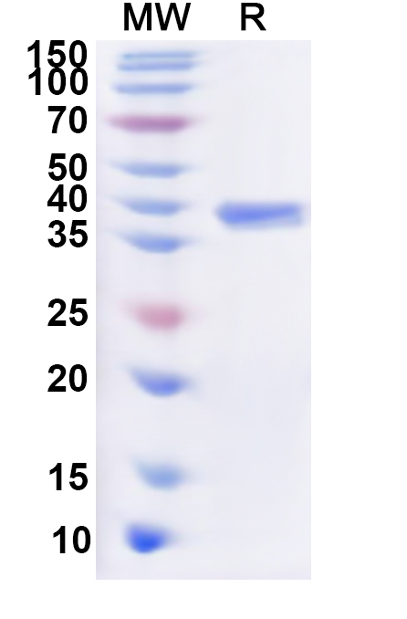 SDS-PAGE for Recombinant Human VIPR2 Protein, N-GST & C-His
