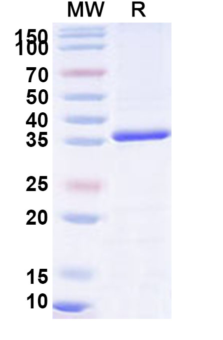 SDS-PAGE for Recombinant Human VPS26A Protein, N-His